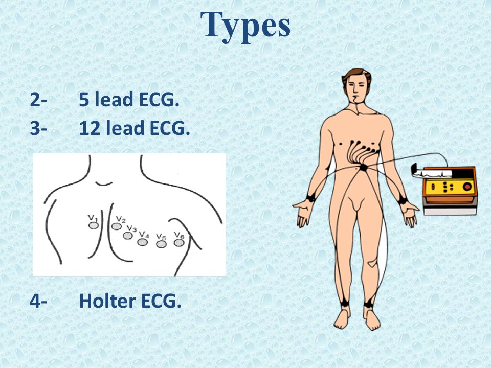 Types 2- 5 lead ECG lead ECG. 4- Holter ECG.
