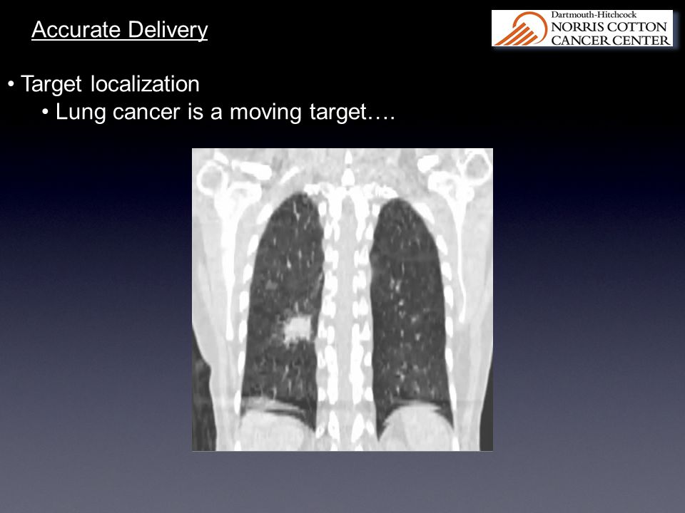 Accurate Delivery Target localization Lung cancer is a moving target….