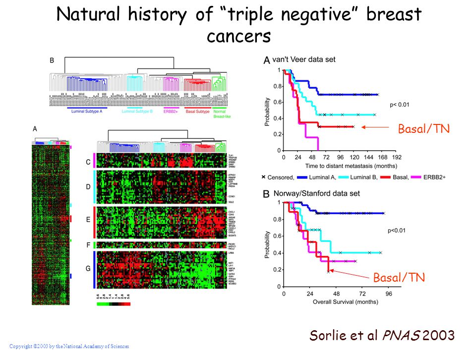 Natural history of triple negative breast cancers