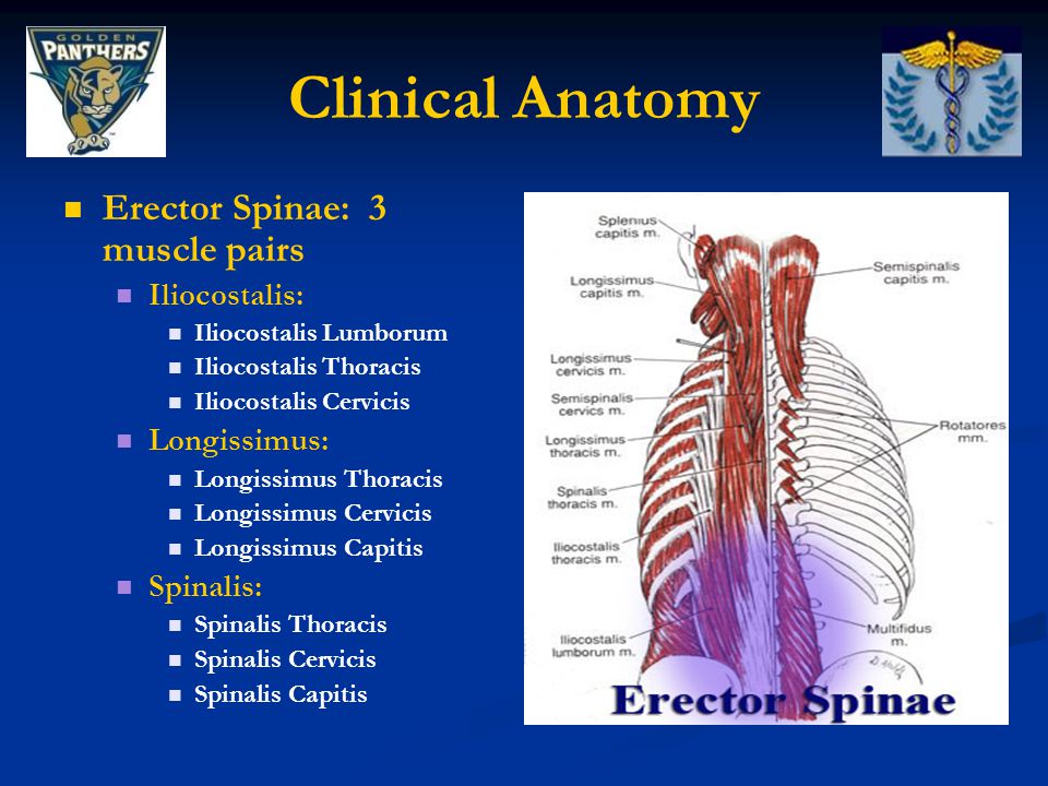 clinical anatomy erector spinae: 3 muscle pairs iliocostalis