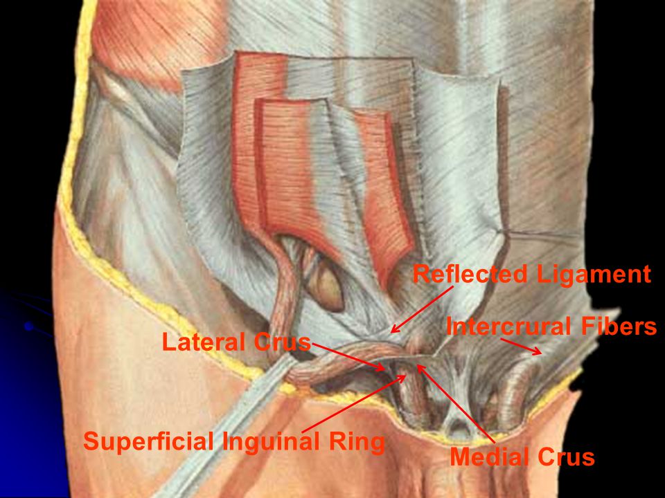 Superficial anal fissure