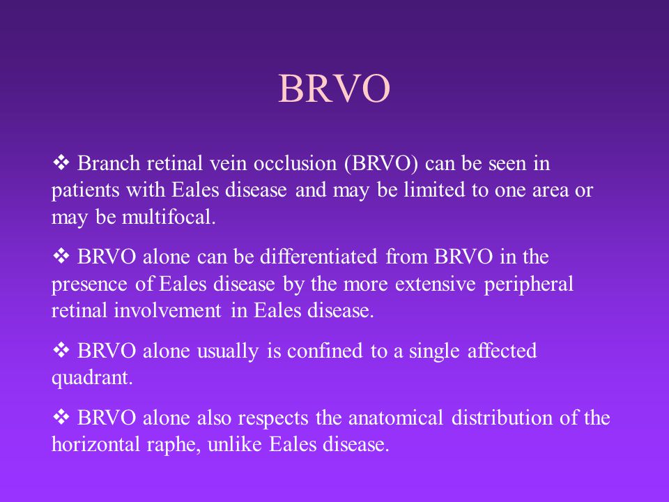 BRVO Branch retinal vein occlusion (BRVO) can be seen in patients with Eales disease and may be limited to one area or may be multifocal.