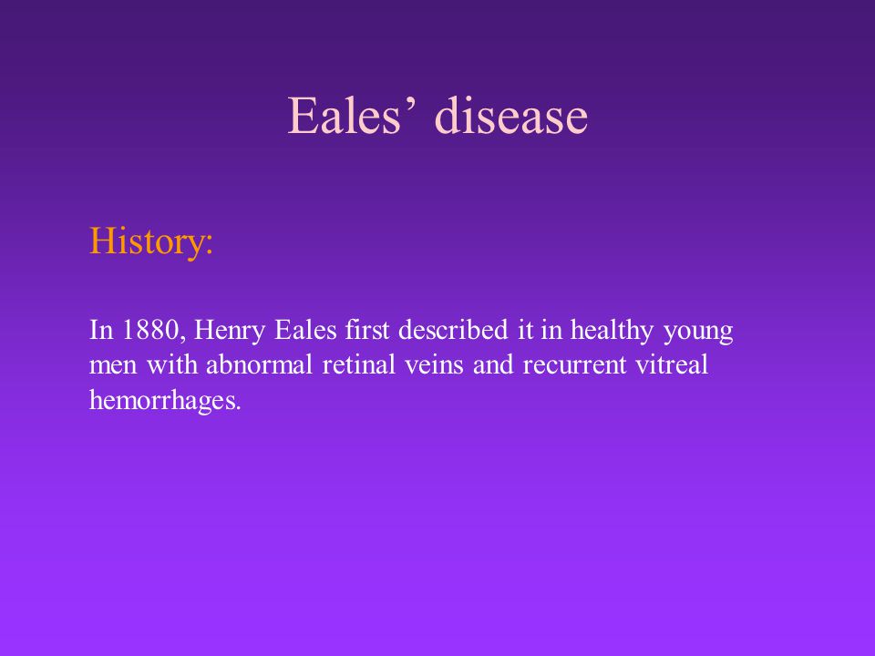 Eales’ disease History: