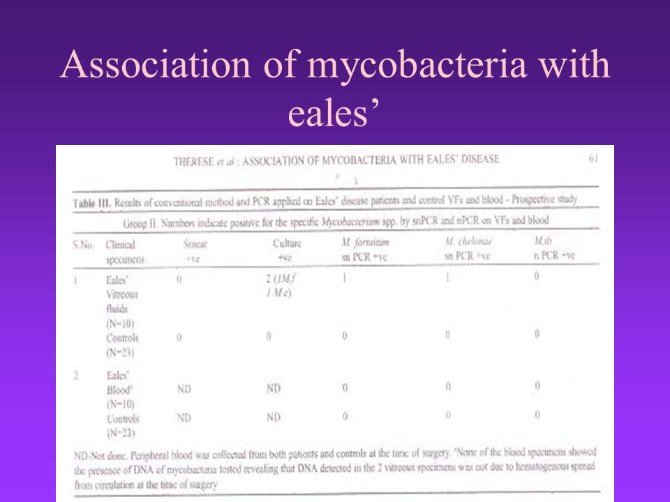 Association of mycobacteria with eales’