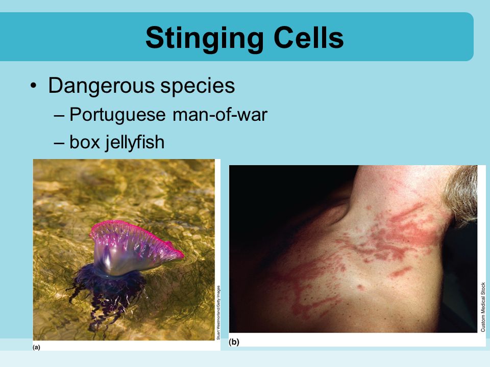 Stinging Cells Dangerous species Portuguese man-of-war box jellyfish