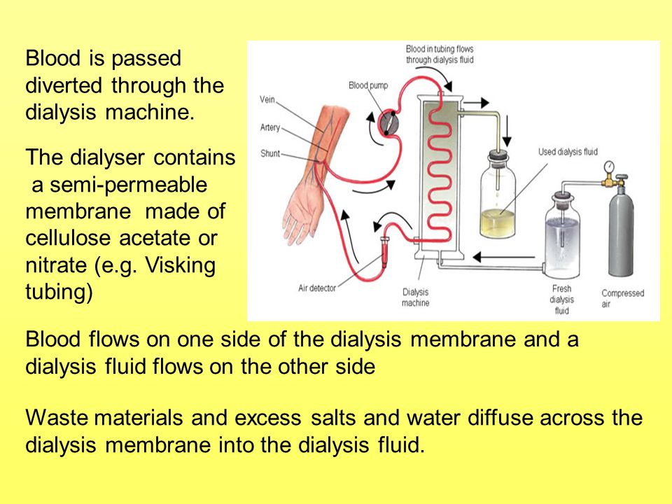 Blood is passed diverted through the dialysis machine. The dialyser contains.