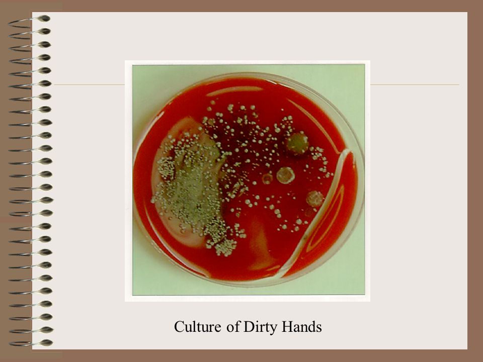 Culture of Dirty Hands