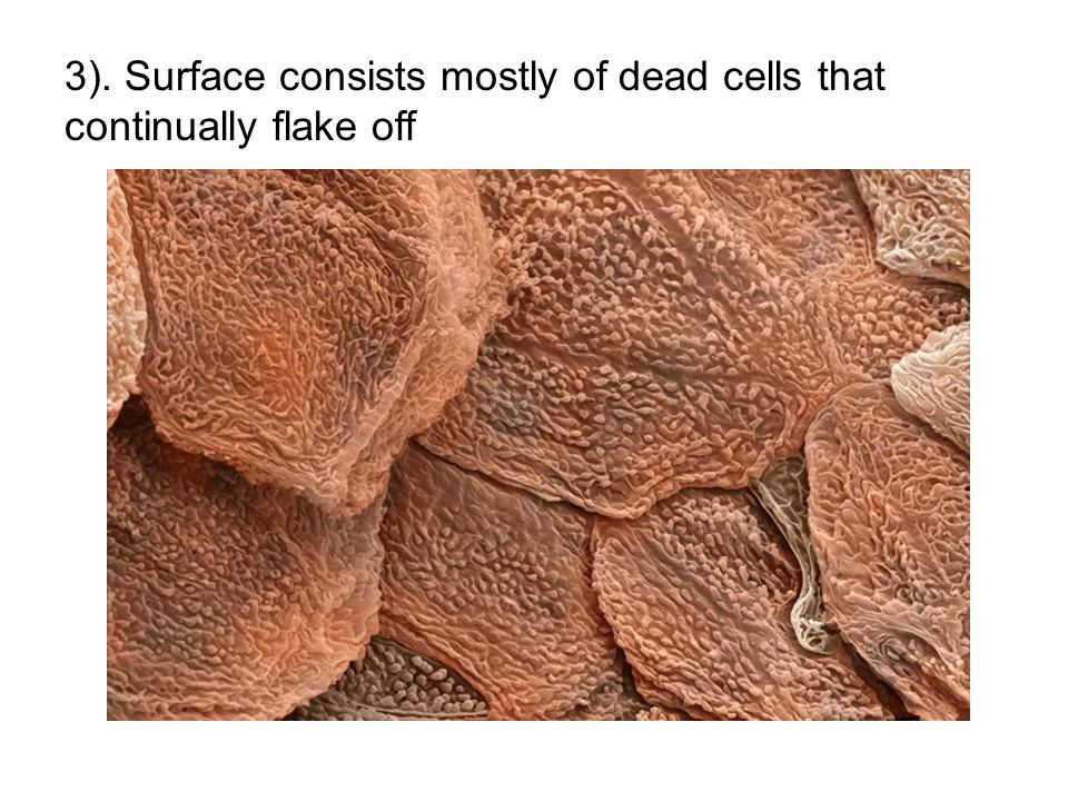 3). Surface consists mostly of dead cells that continually flake off