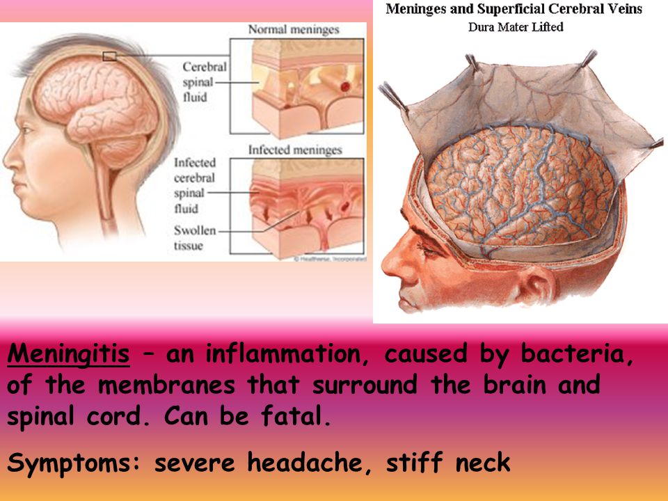 Meningitis – an inflammation, caused by bacteria, of the membranes that surround the brain and spinal cord. Can be fatal.