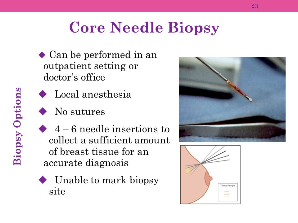 Mature tube needle