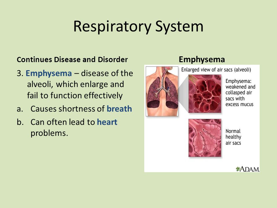 Respiratory System Emphysema