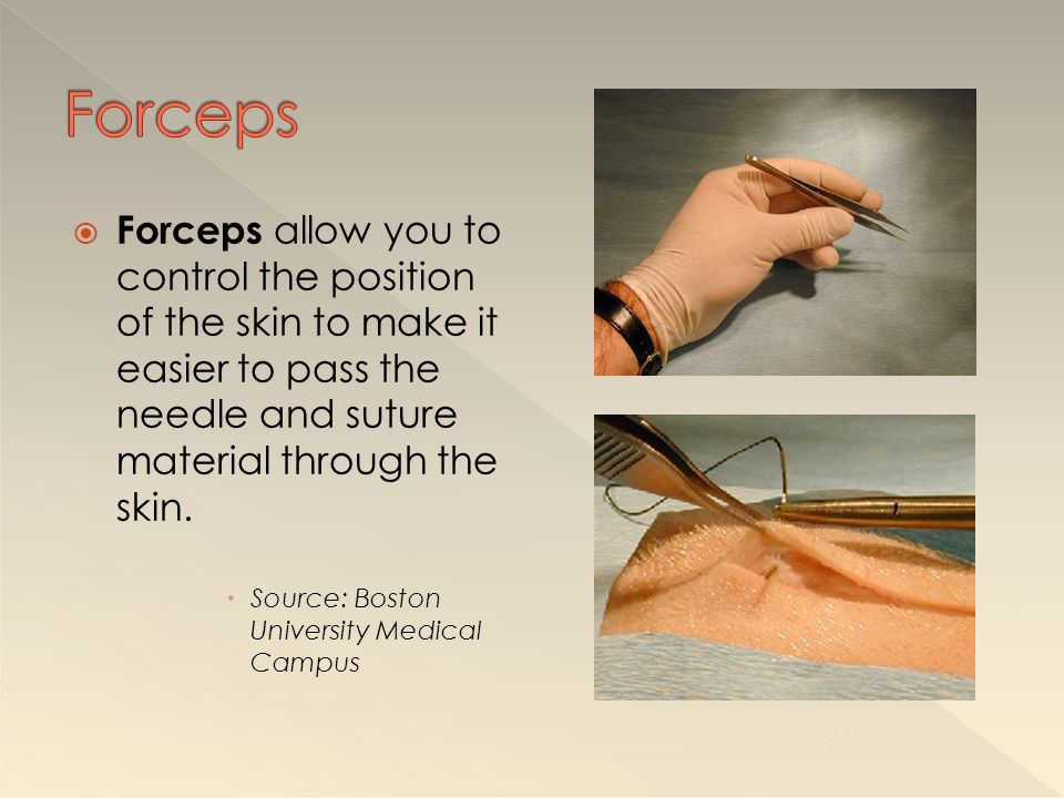 Forceps Forceps allow you to control the position of the skin to make it easier to pass the needle and suture material through the skin.