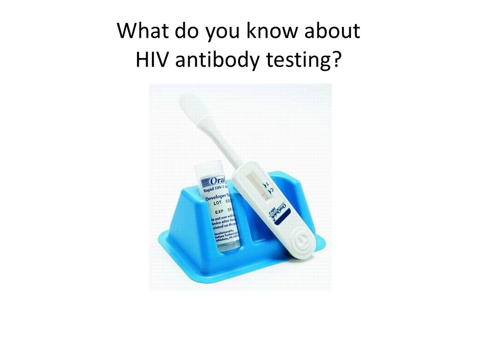 What do you know about HIV antibody testing