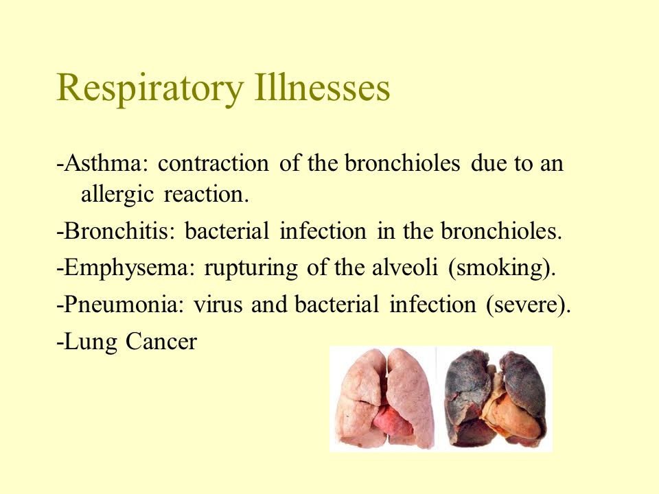Respiratory Illnesses