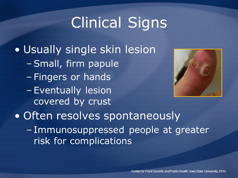 Clinical Signs Usually single skin lesion Often resolves spontaneously