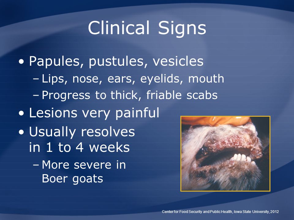 Clinical Signs Papules, pustules, vesicles Lesions very painful