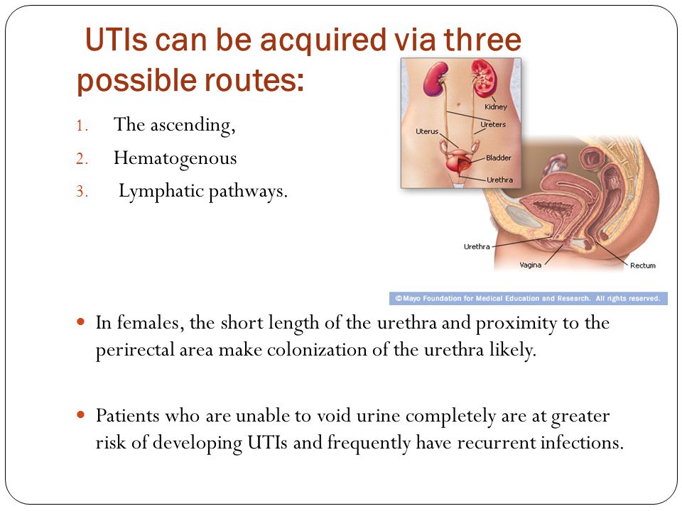 UTIs can be acquired via three possible routes: