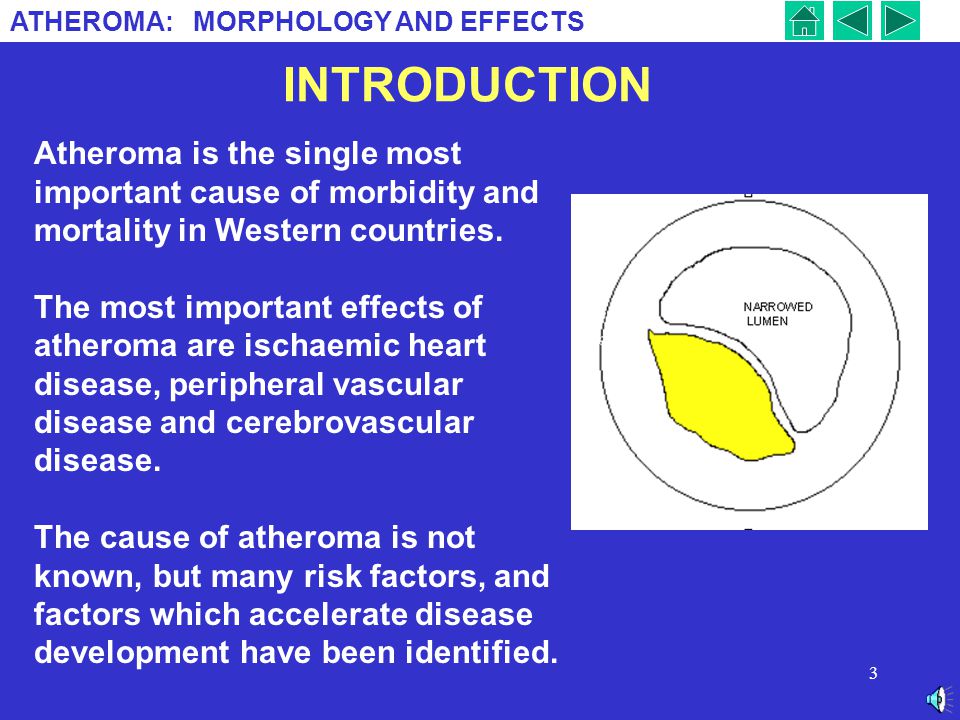 INTRODUCTION Atheroma is the single most important cause of morbidity and mortality in Western countries.
