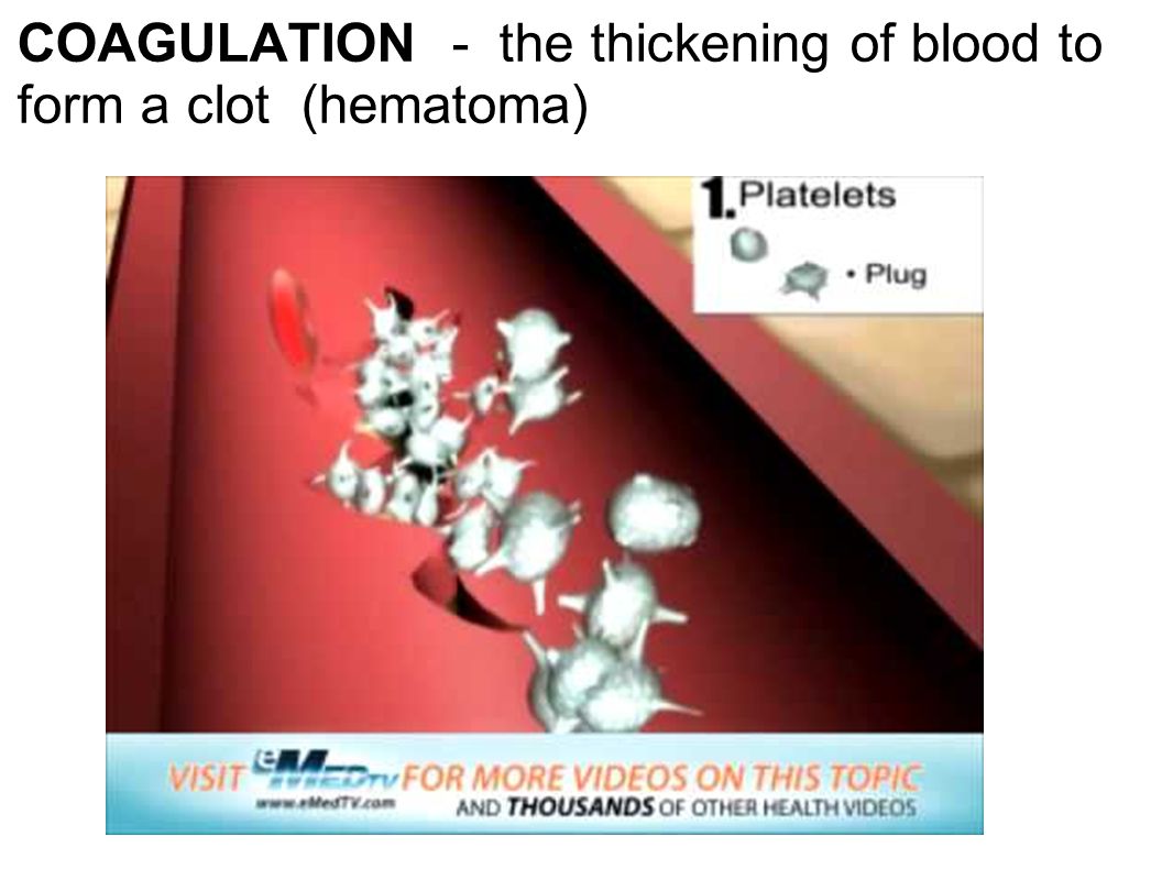 COAGULATION - the thickening of blood to form a clot (hematoma)