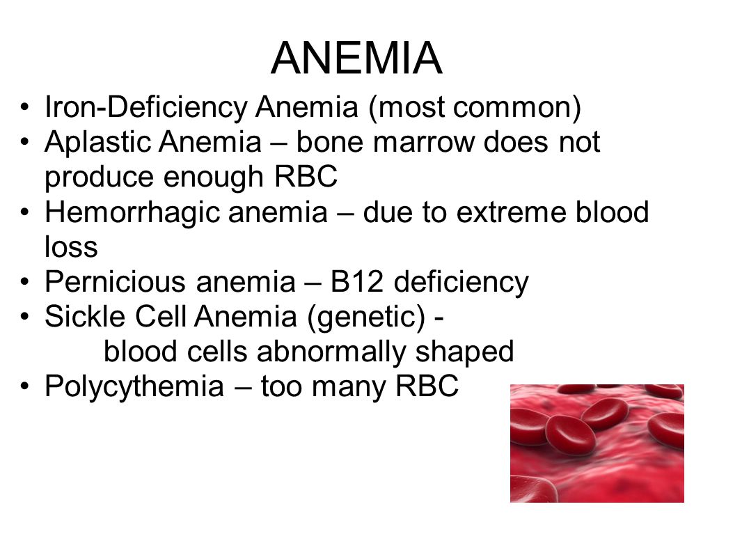 ANEMIA Iron-Deficiency Anemia (most common)