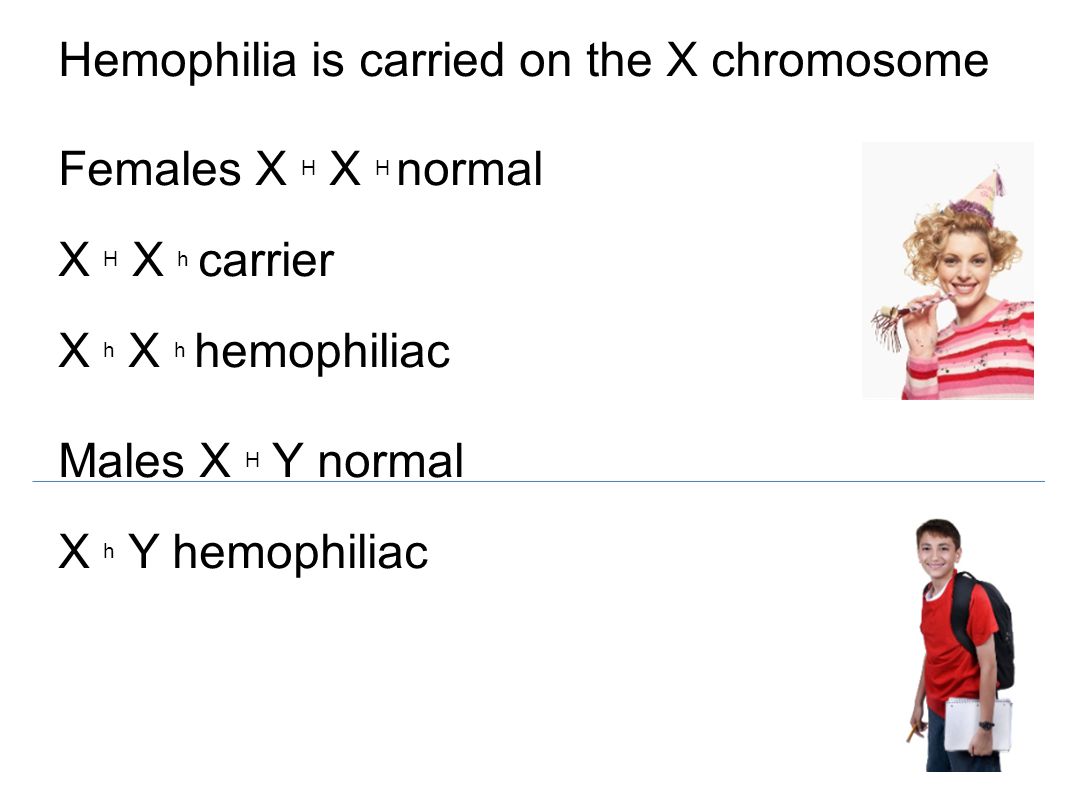 Hemophilia is carried on the X chromosome