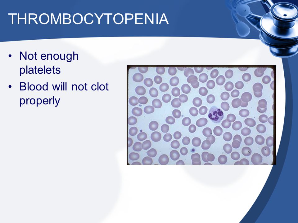 THROMBOCYTOPENIA Not enough platelets Blood will not clot properly