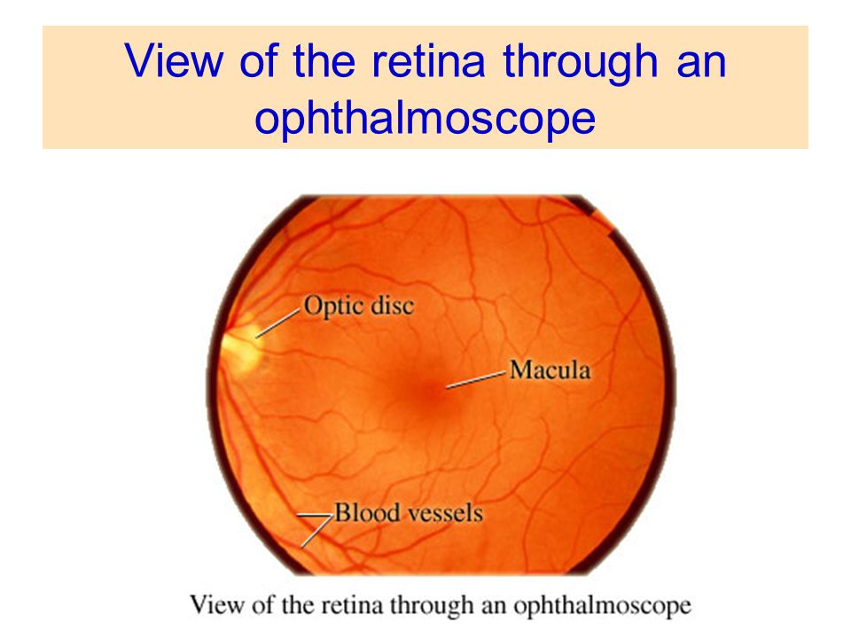 View of the retina through an ophthalmoscope
