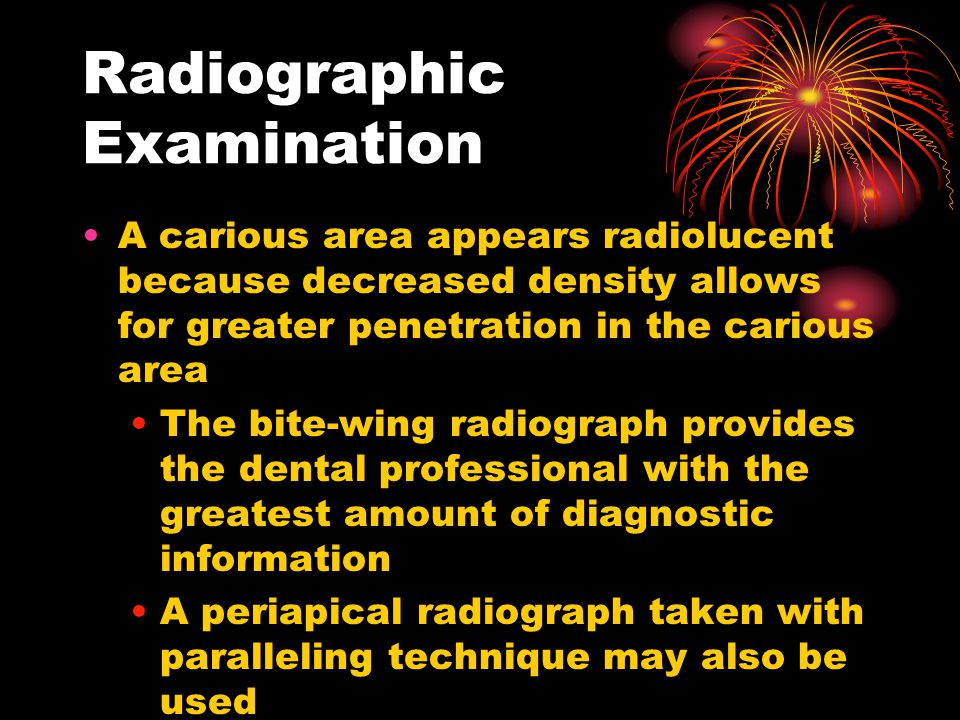 radiographic interpretation.