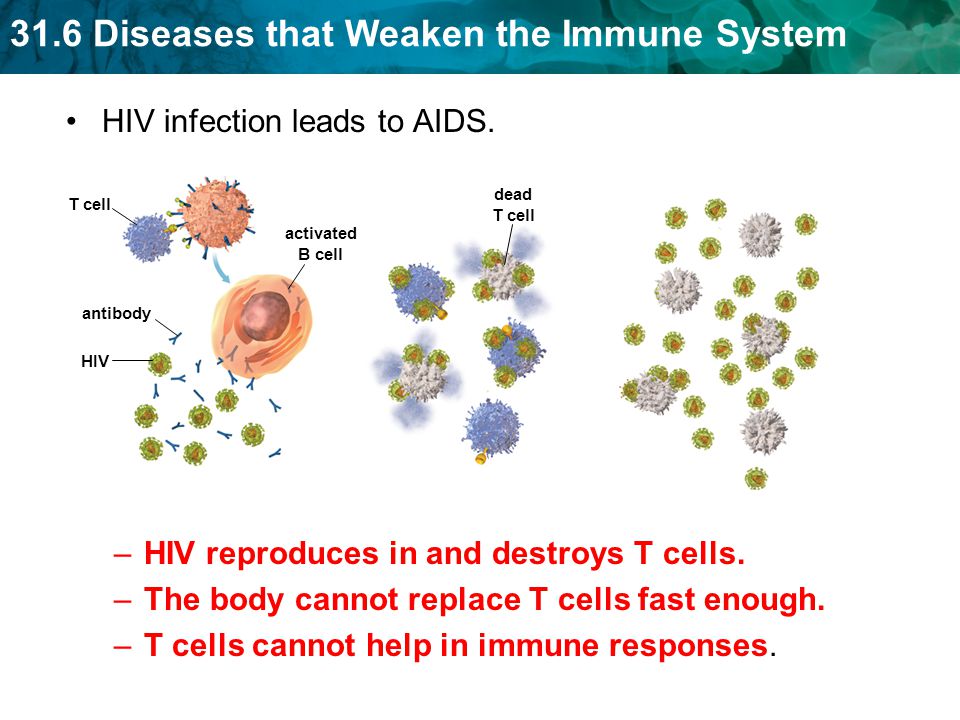 HIV infection leads to AIDS.