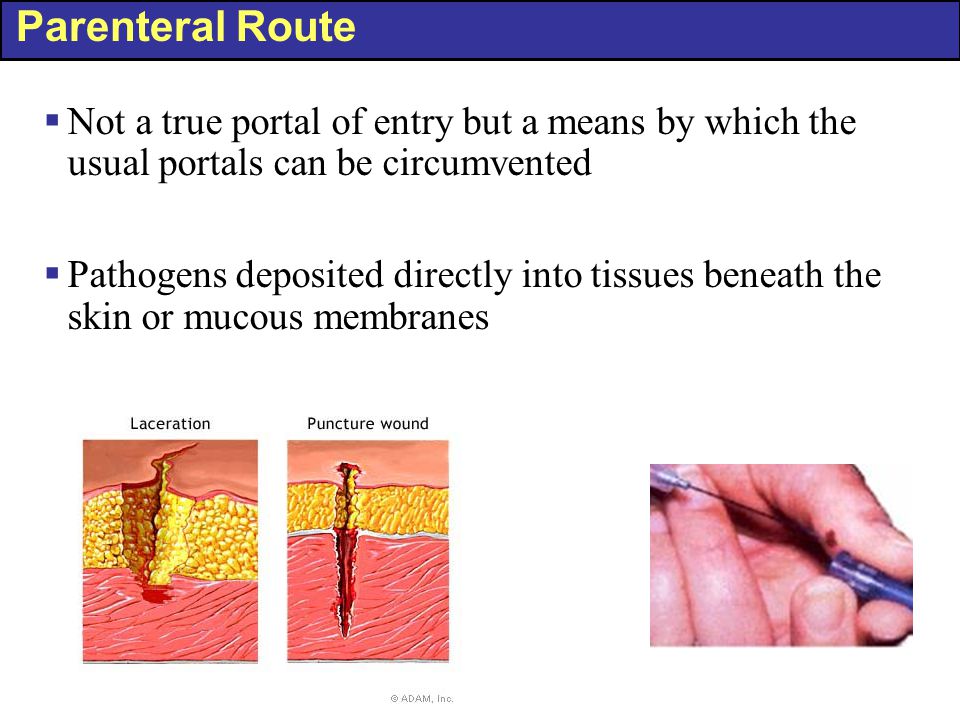 Parenteral Route Not a true portal of entry but a means by which the usual portals can be circumvented.