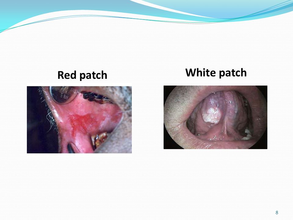 Red patch White patch