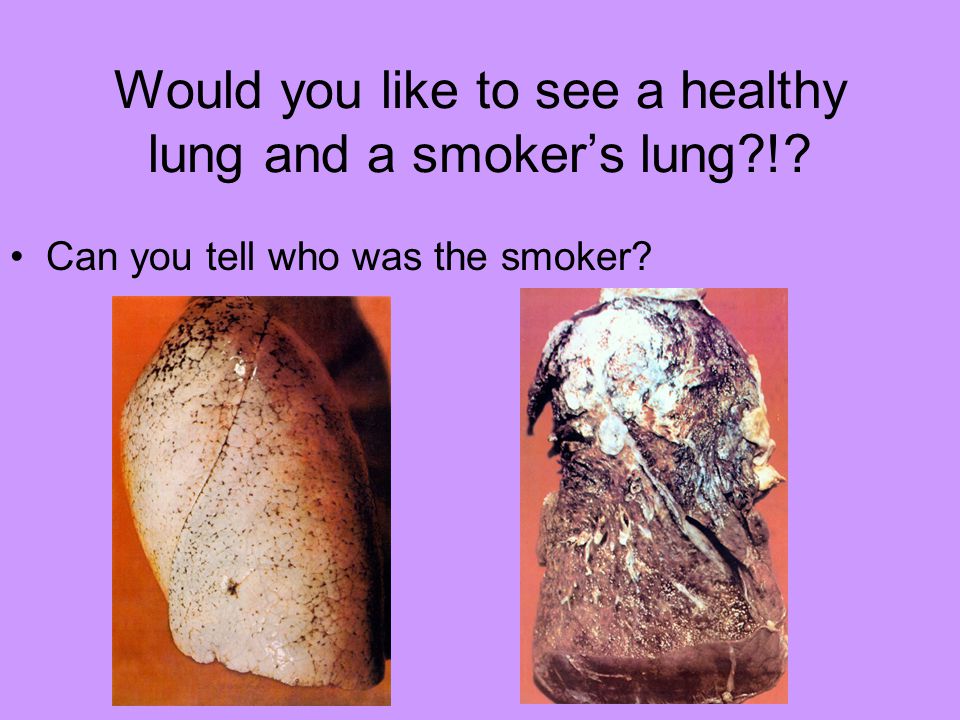 Would you like to see a healthy lung and a smoker’s lung !