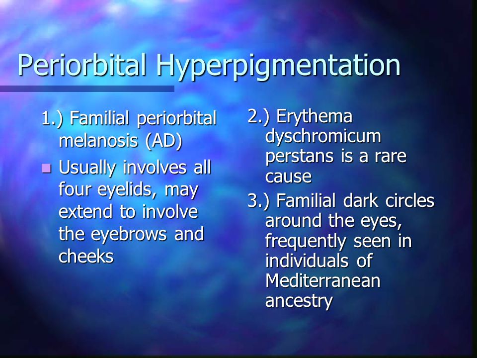 Periorbital Hyperpigmentation