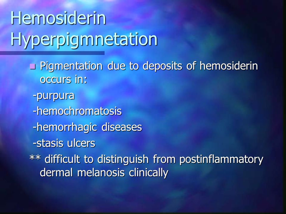 Hemosiderin Hyperpigmnetation