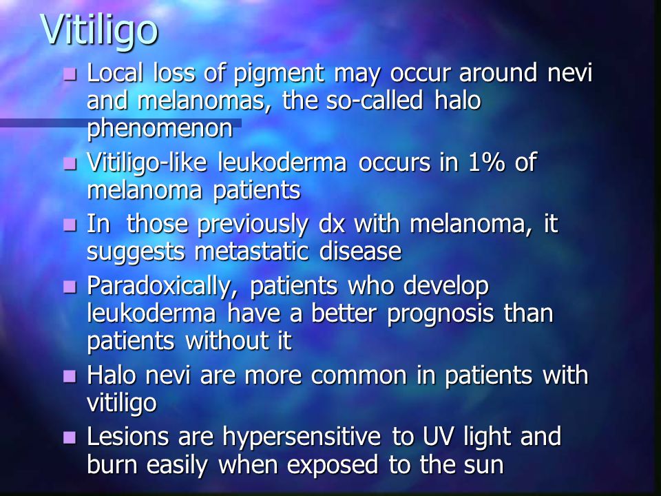 Vitiligo Local loss of pigment may occur around nevi and melanomas, the so-called halo phenomenon.
