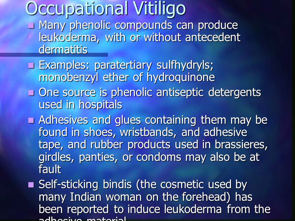 Occupational Vitiligo