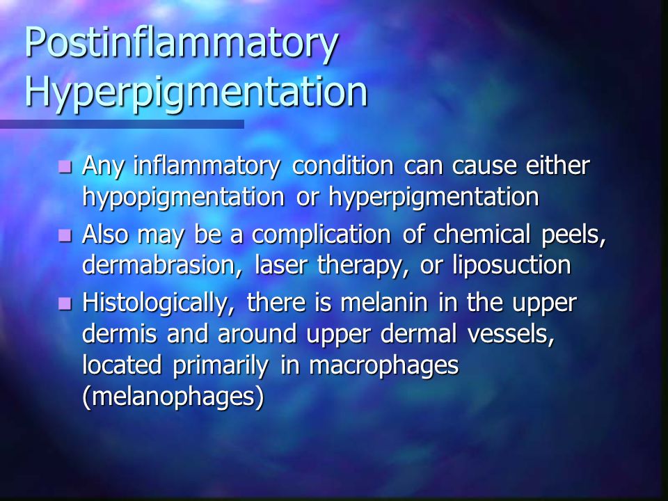 Postinflammatory Hyperpigmentation
