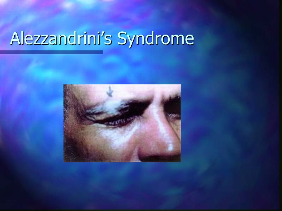 Alezzandrini’s Syndrome