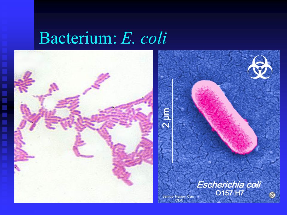 Bacterium: E. coli