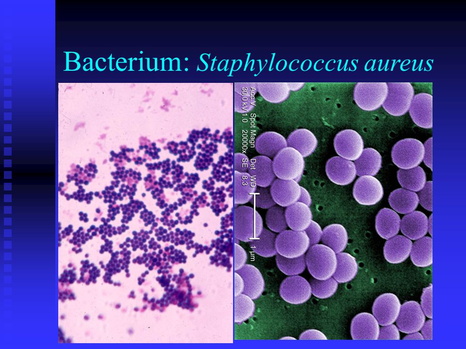 Bacterium: Staphylococcus aureus