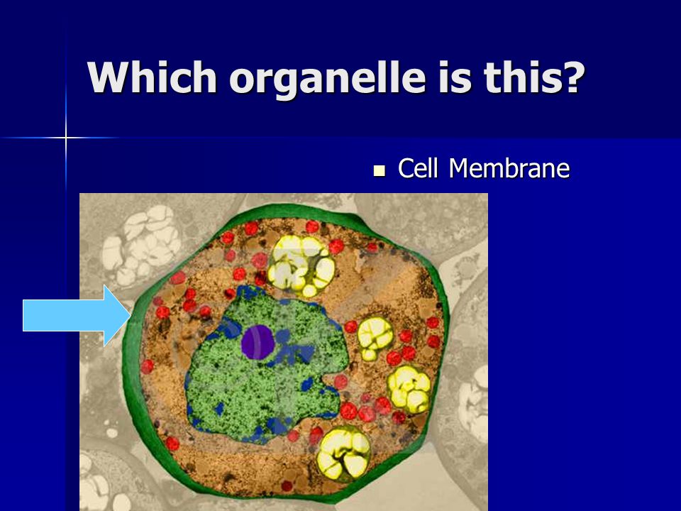 Which organelle is this
