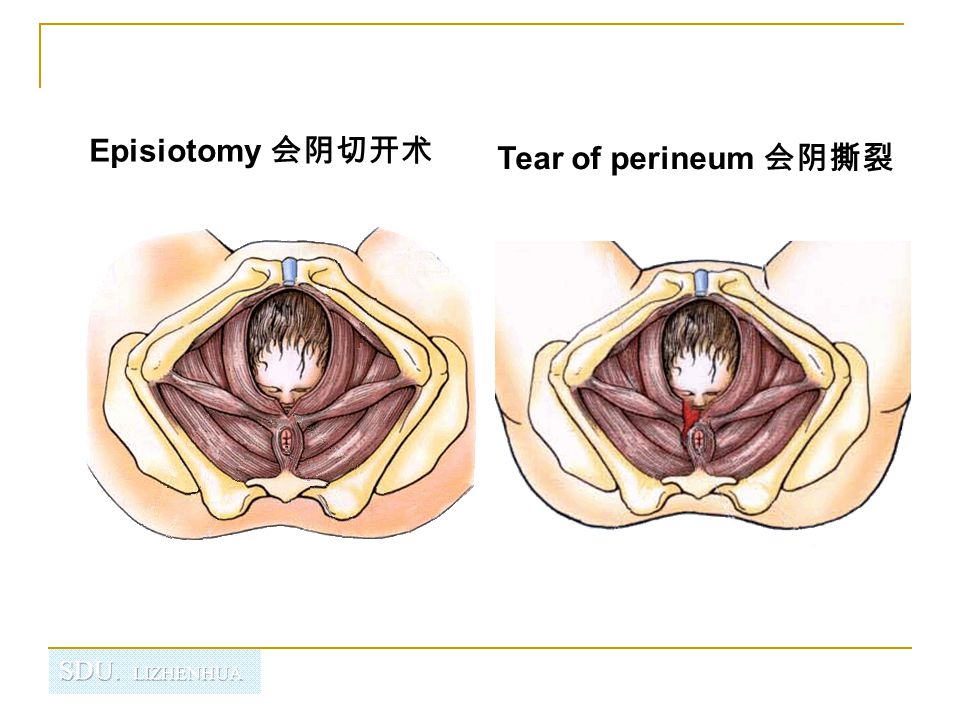 perineum会阴 山东大学医学院 解剖教研室 李振华.