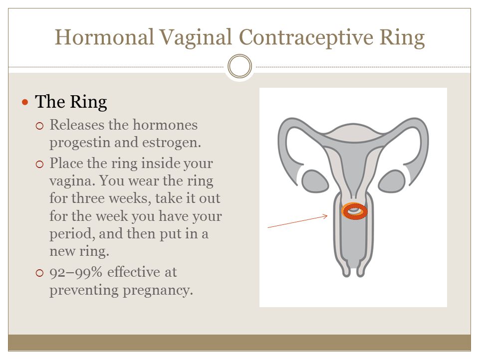 Hormonal Vaginal Contraceptive Ring