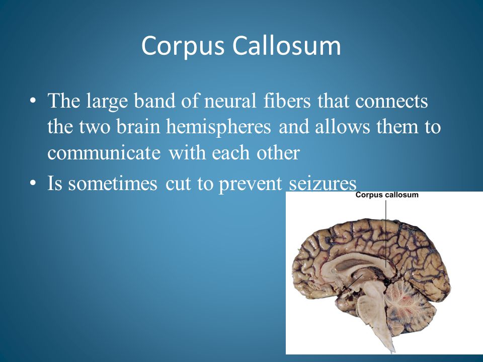Corpus Callosum The large band of neural fibers that connects the two brain hemispheres and allows them to communicate with each other.