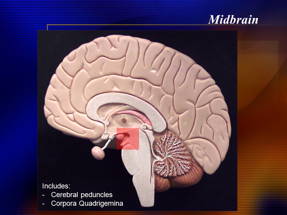 Midbrain Includes: Cerebral peduncles Corpora Quadrigemina