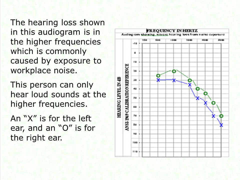 The hearing loss shown in this audiogram is in the higher frequencies which is commonly caused by exposure to workplace noise.