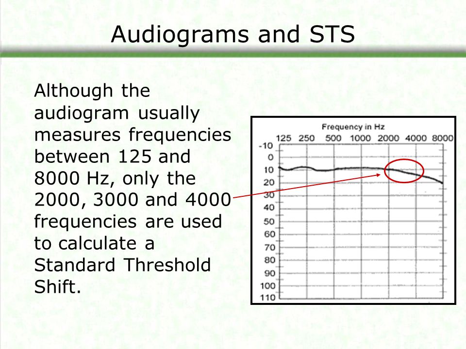 Audiograms and STS