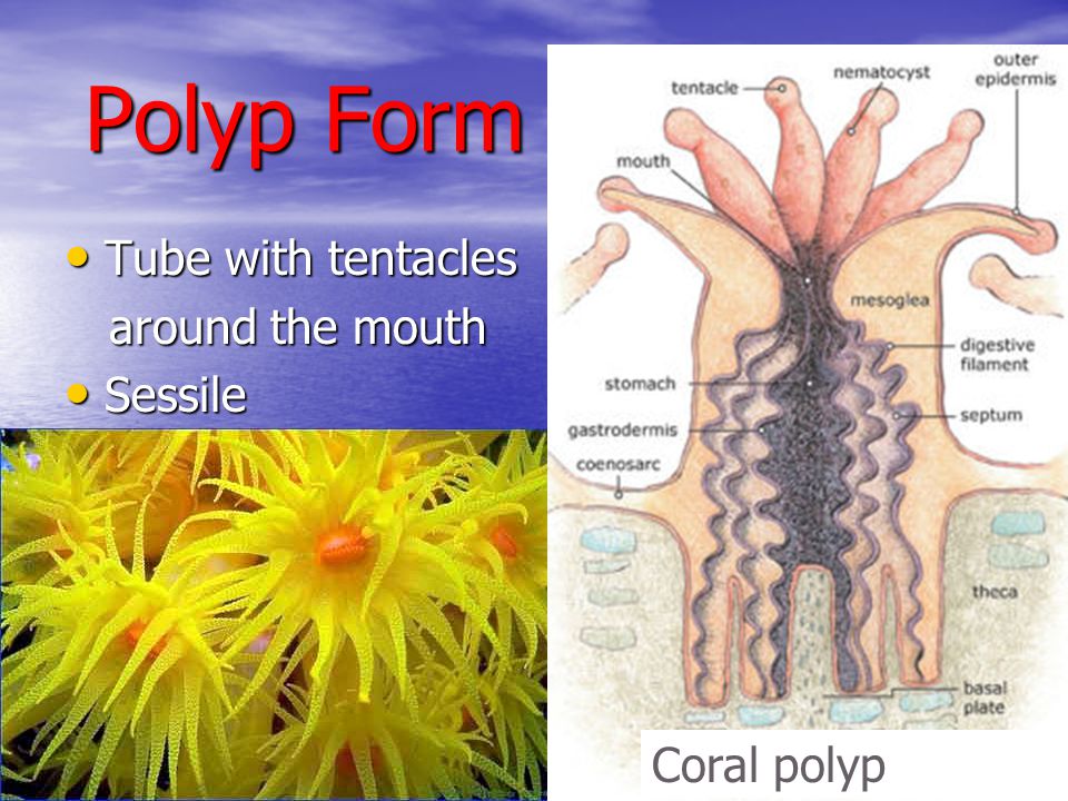 Polyp Form Tube with tentacles around the mouth Sessile Coral polyp