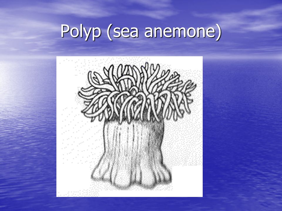Polyp (sea anemone)