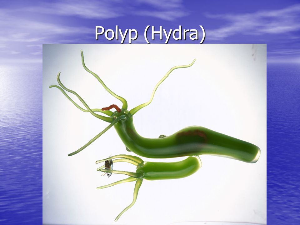 Polyp (Hydra)